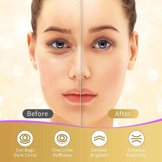 Mascarilla para debajo de los ojos de oro de 24 quilates